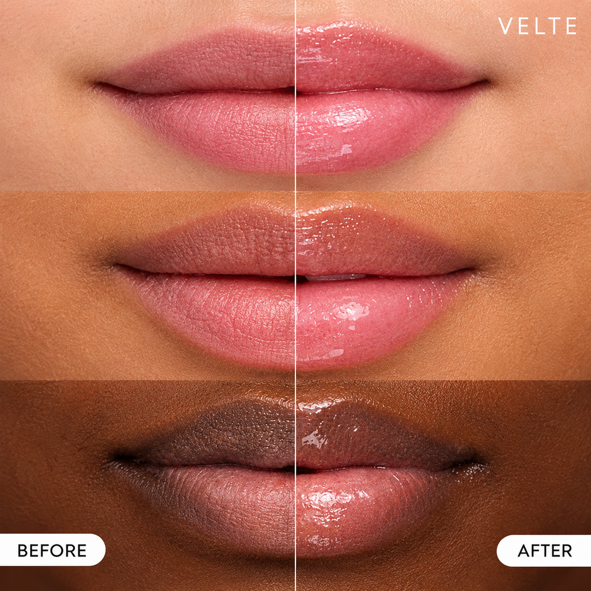 Lip Mask